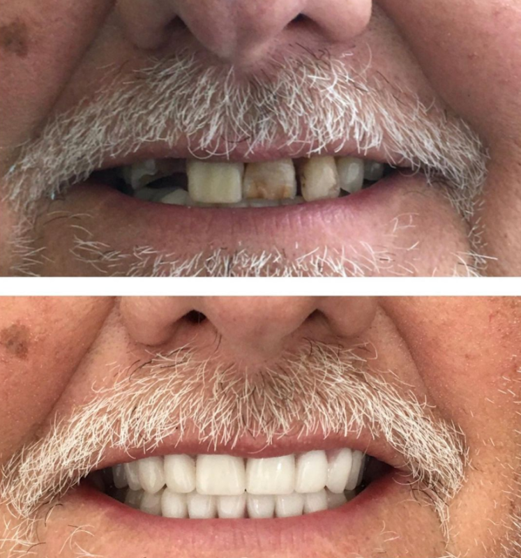 Janée G Atkinson DDS